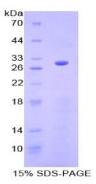 SDS-PAGE (GRN-7847H).jpg